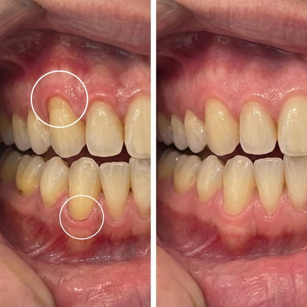 Encivital® Polvo de Colágeno para Encías