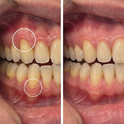 Encivital® Polvo de Colágeno para Encías
