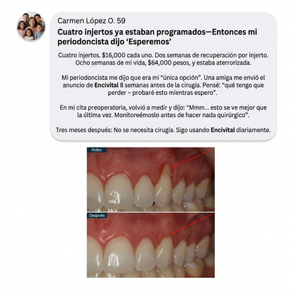 Encivital® Polvo de Colágeno para Encías