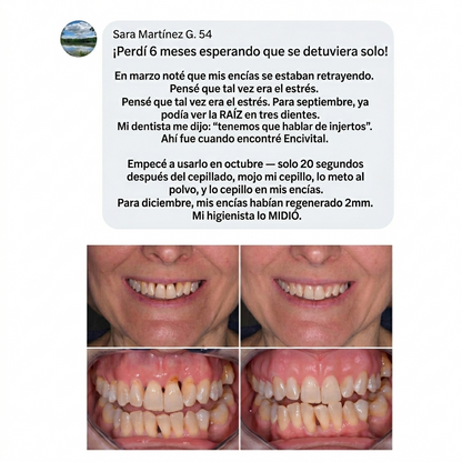 Encivital® Polvo de Colágeno para Encías